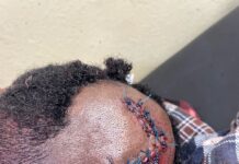 Police Restore Calm at Gomoa Dominase After Fatal Demolition Clash; Six Arrested