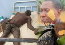 Two Police Officers Injured in Kukurantumi Youth Clashes over Suspect’s Death