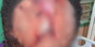 Blood on the Lake: Fishing Feud Between Ewe and Zabrama Communities Leaves Several Injured in Krachi East