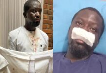 Assault In Tamale: Top Ghanaian Artist Ibrahim Mahama Alleges Police Brutality, IGP Orders Probe