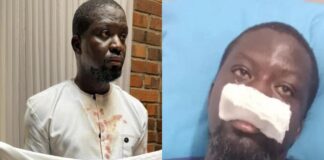 Assault In Tamale: Top Ghanaian Artist Ibrahim Mahama Alleges Police Brutality, IGP Orders Probe